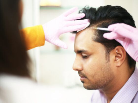 gfc-treatment-SD Road-Secunderabad